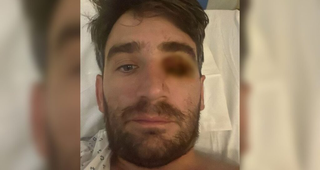 Fiesta de Año Nuevo: Hombre pierde un ojo tras explosión de fuego pirotécnico